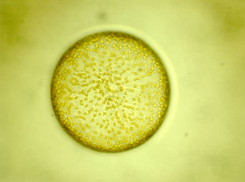 Hvordan bli kvitt lakselus?